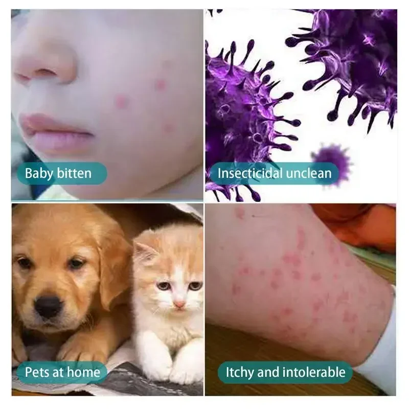 30ml Pet Expel Fleas Lice Treatments Spray Quick And Handy Fleas Ticks Expellent For Dogs Cats Pet Health Supplies - Image 3